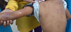 balika